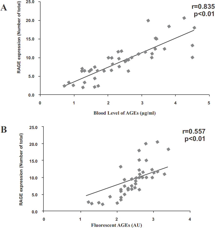 Circulating AGEs shows significant positive correlation with RAGE m-RNA expression among diabetic subjects. (A) Relationship between circulating AGEs and RAGE m-RNA expression among diabetic subjects. (B) Relationship between fluorescent AGEs and RAGE m-RNA expression among diabetic subjects. Correlation analysis was performed using Pearson's coefficient.