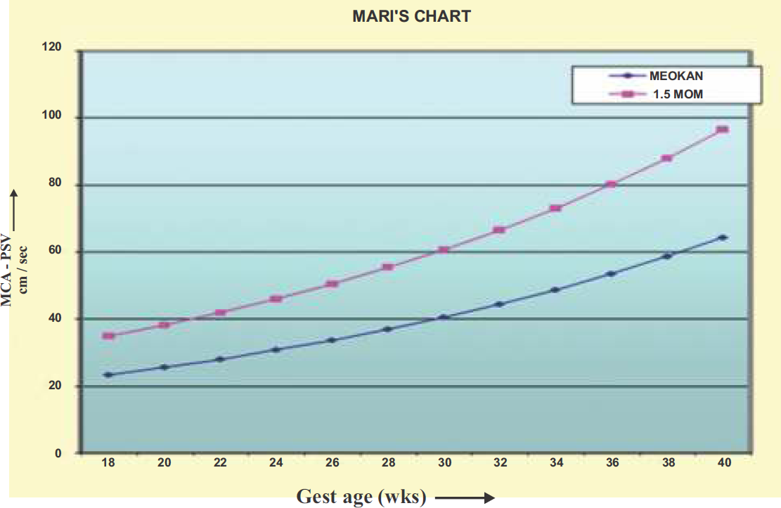 The Mari et al (42) chart developed to show an association between Middle Cerebral Artery-Peak Systolic Velocity in reference to gestational age. The graph line marked with filled rectangles marks the cut-off value in 1.5 MoMs of MCA-PSV for the gestational age.