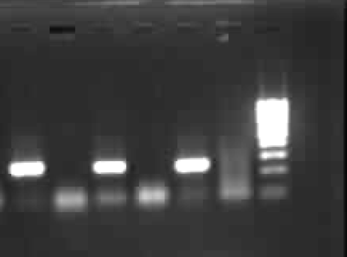 HCV RNA - RT PCR results (lane 1, 3, 5 HCV positive sera, Lane 2,4 & 6 were negative sera and lane 7 Mol wt marker 100 bp ladder (left to right).