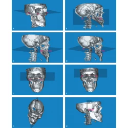 Article figure