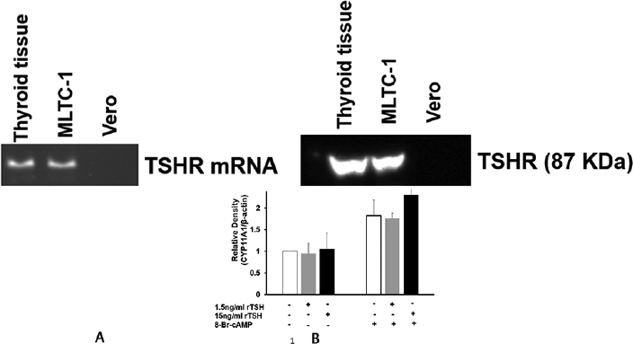 Presence of (A) TSHR mRNA and (B) TSHR protein in thyroid tissue and mouse Leydig tumor cell line-1 cells.