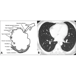 Article figure