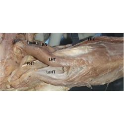 Article figure