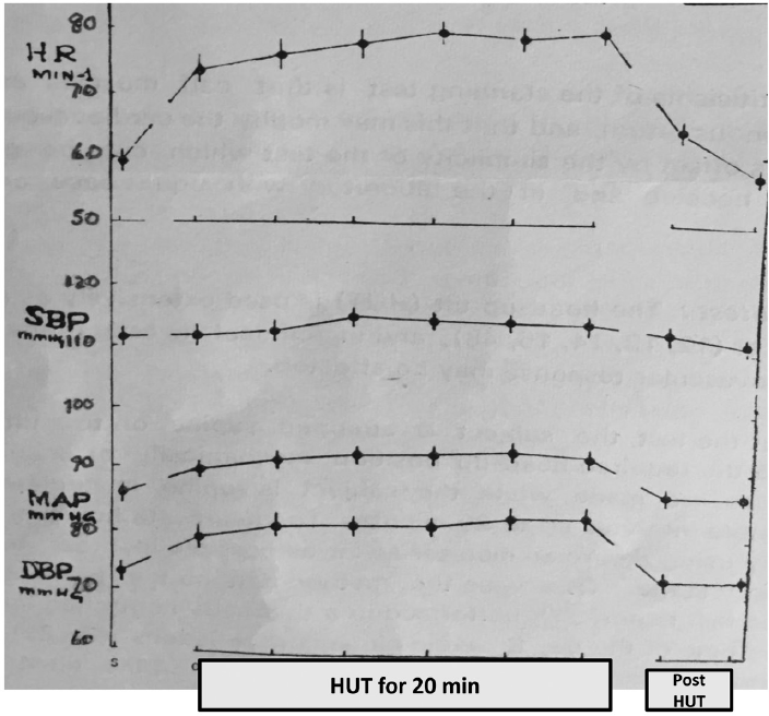 Cardiovascular system (CVS) response of normal young males to 70-degree head-up tilt (HUT).56