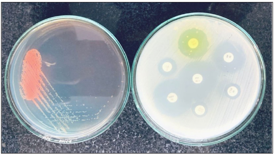 Urine Culture and sensitivity test.