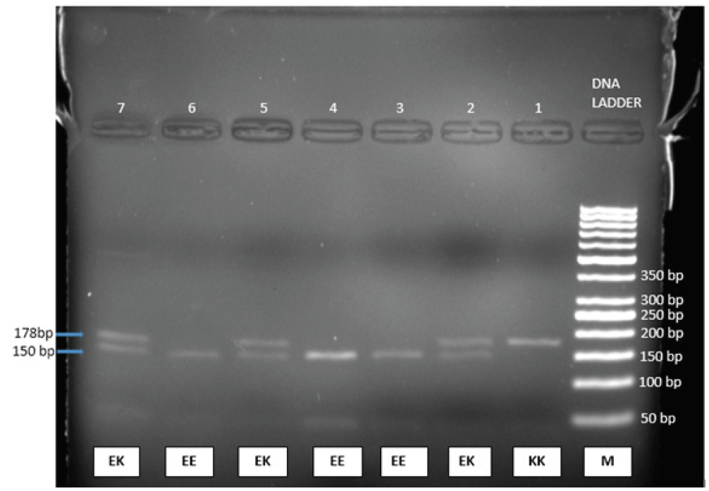 KCNJ11 gene polymerase chain reaction (PCR) products were broken down using the BanII restriction enzyme. At 150 bp, homozygous EE has a single band. There are two bands at 178 bp and 150 bp in heterozygous EK. The homozygous KK sample was electrophoresed on a 2% agarose gel, revealing a single band at 170 bp. Lane 1 displays the homozygote KK genotype, lanes 2, 4, and 7 the heterozygote EK genotype, and lanes 3, 4, and 6 the homozygote EE genotype. M is a DNA ladder (50 bp ladder). Due to their extremely small size, the bands corresponding to sizes 32 and 28 bp are invisible in the gel.