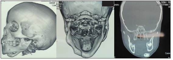 Intraoral examination shows no abnormalities.