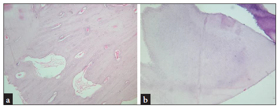 (a) Normal bone with marrow spaces; (b) Dentinal tubules. Histopathologic photomicrograph (Hematoxylin and Eosin stained section under 10x magnification).